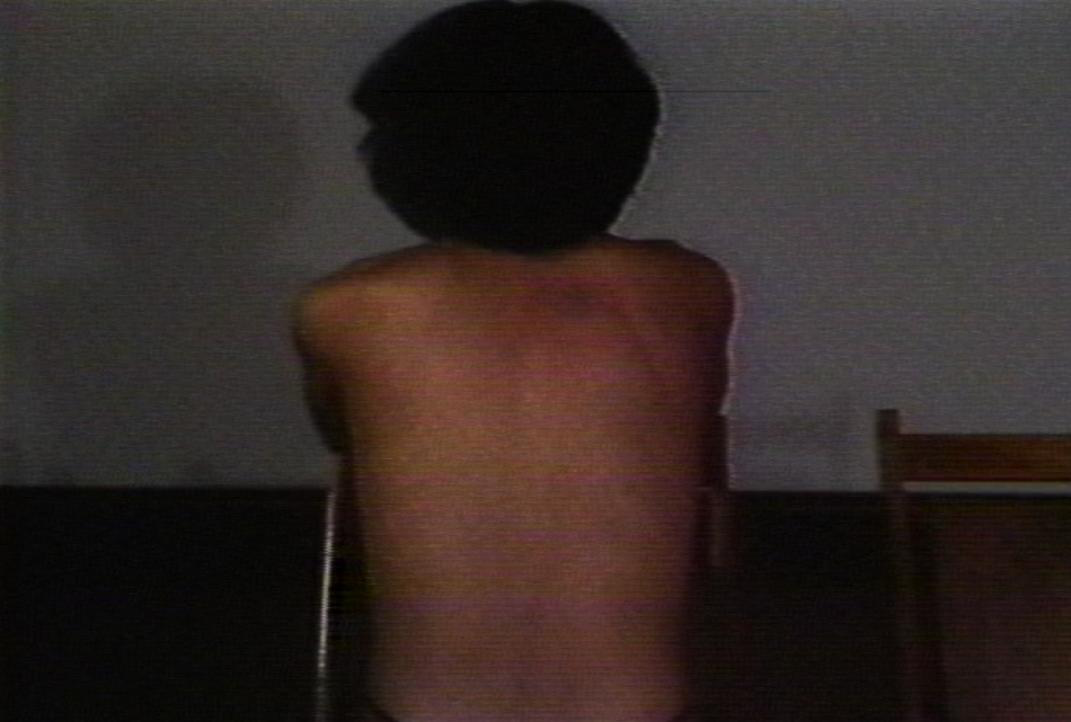 60 unit bruise.png 60 unit bruise.png
